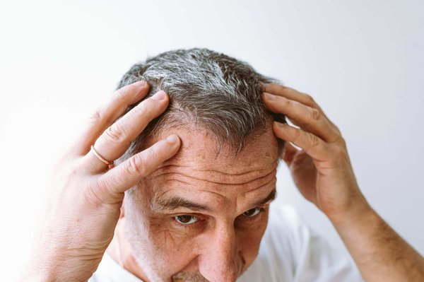 La Turquie : une destination idéale pour une greffe de cheveux réussie