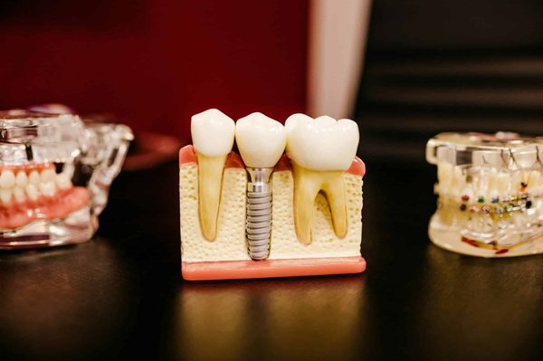 Gestion de la douleur en dentisterie : techniques et conseils